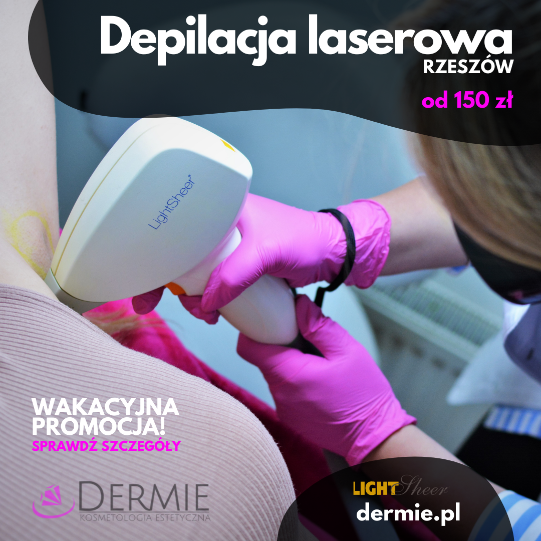 dermie-depilacja-laserowa
